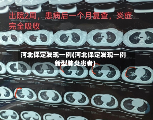 河北保定发现一例(河北保定发现一例新型肺炎患者)