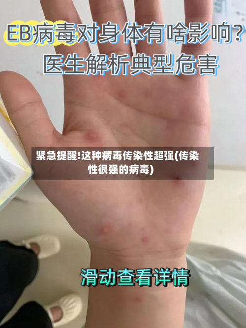 紧急提醒!这种病毒传染性超强(传染性很强的病毒)-第2张图片