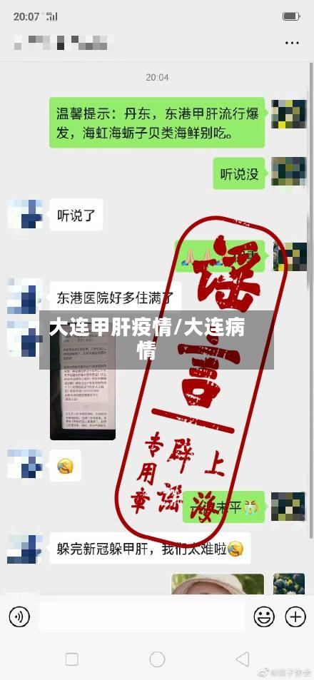大连甲肝疫情/大连病情-第2张图片